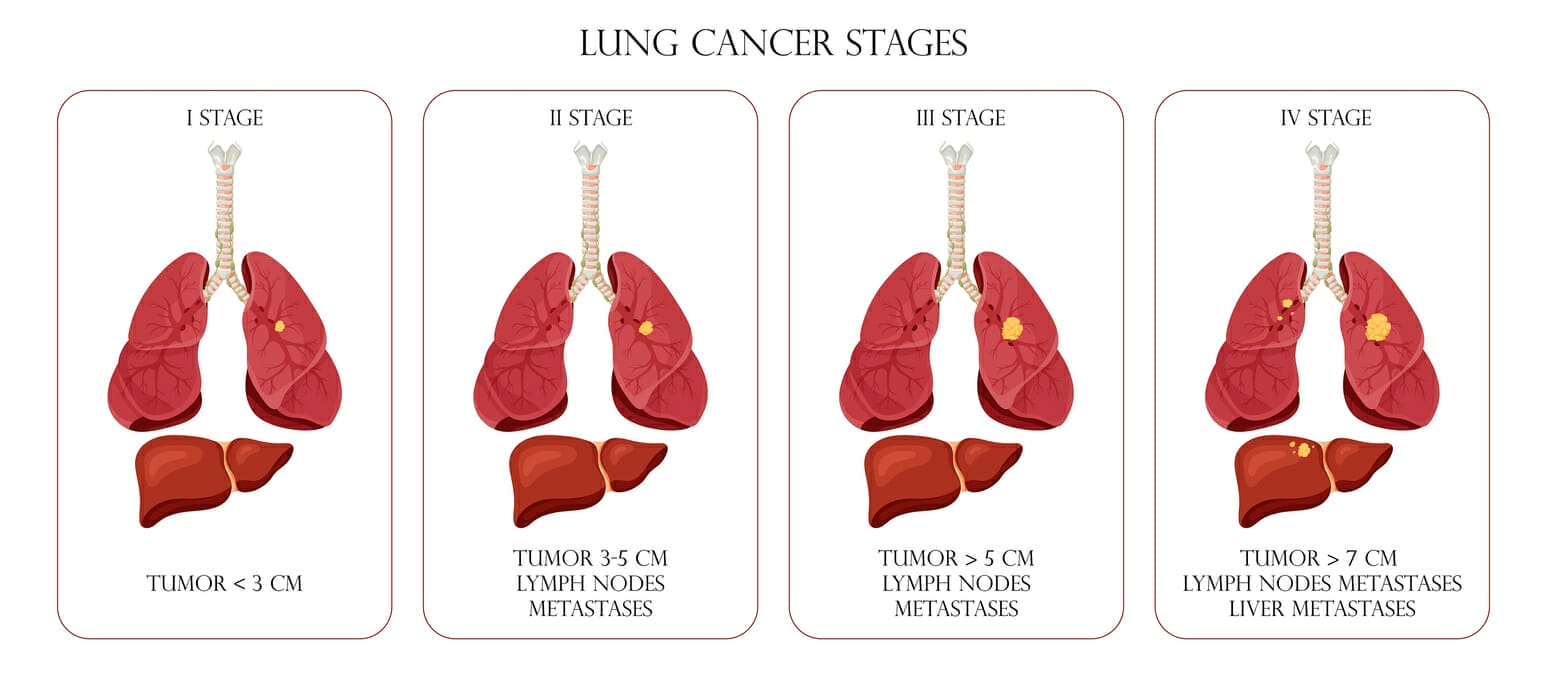cost of liver cancer treatment